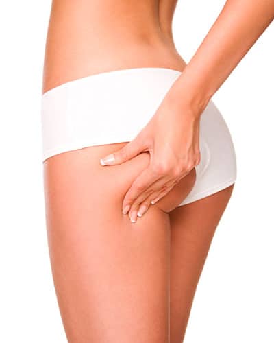 thighlift Brazilian Butt Lift Los Altos CA