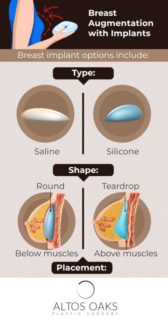 Altos-Oaks-Plastic-Surgery-breast-augmentation-with-implants-infographic